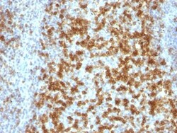 PD-1 Antibody (PDCD1/922), Novus Biologicals 0.2mg; Unlabeled:Antibodies,