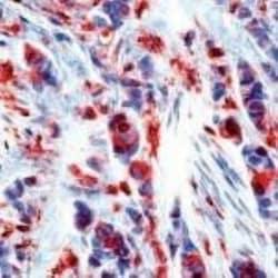 PD-ECGF/Thymidine Phosphorylase Antibody (PGF 44C) - BSA Free, Novus Biologicals:Antibodies:Primary