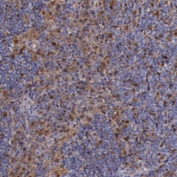 PD-ECGF/Thymidine Phosphorylase Antibody, Novus Biologicals 25ul | Buy Online | Novus Biologicals | Fisher Scientific