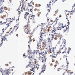 PD-ECGF/Thymidine Phosphorylase Antibody, Novus Biologicals 25ul | Buy Online | Novus Biologicals | Fisher Scientific