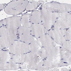 PD-ECGF/Thymidine Phosphorylase Antibody, Novus Biologicals 25ul | Buy Online | Novus Biologicals | Fisher Scientific