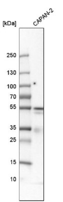 PD-ECGF/Thymidine Phosphorylase Antibody, Novus Biologicals 25ul | Buy Online | Novus Biologicals | Fisher Scientific