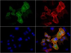 PD-L1 Antibody - BSA Free, Novus Biologicals 0.1mg; Unlabeled:Antibodies,