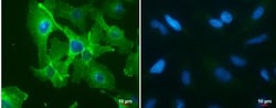 PD-L1 Antibody, Novus Biologicals 0.1mL; Unlabeled:Antibodies, Polyclonal