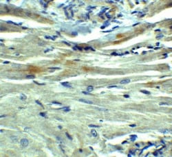 PD-L1 Antibody - BSA Free, Novus Biologicals 0.1mg; Unlabeled:Antibodies,