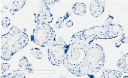 PD-L1 Antibody, Novus Biologicals 0.1mg; Unlabeled:Antibodies