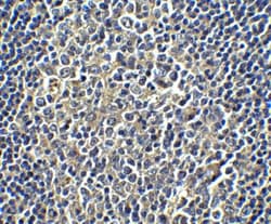 PD-L1 Antibody - BSA Free, Novus Biologicals 0.1mg; Unlabeled:Antibodies,