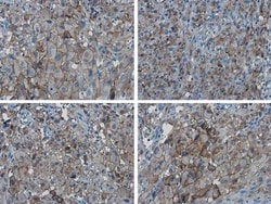PD-L1 Antibody, Novus Biologicals 0.1mL; Unlabeled:Antibodies, Polyclonal