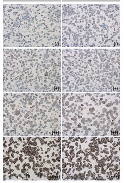 PD-L1 Antibody, Novus Biologicals 0.1mL; Unlabeled:Antibodies, Polyclonal