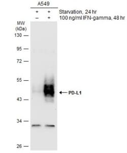 PD-L1 Antibody, Novus Biologicals 0.1mL; Unlabeled:Antibodies, Polyclonal