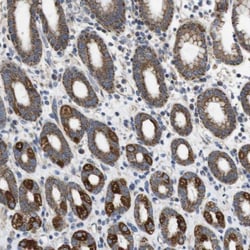 PD-L2/B7-DC/PDCD1LG2 Antibody, Novus Biologicals 0.1mL; Unlabeled:Antibodies,