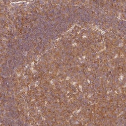 PDAP1 Antibody, Novus Biologicals 25 &mu;L, Unlabeled:Antibodies, Polyclonal