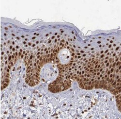 PDCD4 Antibody, Novus Biologicals 25 &mu;L; Unlabeled:Antibodies, Polyclonal