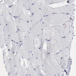 PDCD4 Antibody, Novus Biologicals 25 &mu;L; Unlabeled:Antibodies, Polyclonal