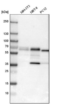 PDCD4 Antibody, Novus Biologicals 25 &mu;L; Unlabeled:Antibodies, Polyclonal