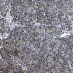 PDCD5 Antibody, Novus Biologicals 25 &mu;L; Unlabeled:Antibodies, Polyclonal