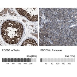 PDCD5 Antibody, Novus Biologicals 25 &mu;L; Unlabeled:Antibodies, Polyclonal