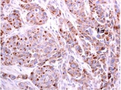 PDCD6 Antibody, Novus Biologicals 0.1mL; Unlabeled:Antibodies, Polyclonal