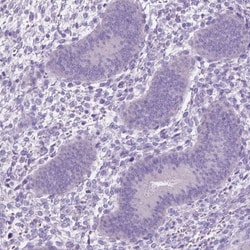 PDCL2 Antibody, Novus Biologicals:Antibodies:Primary Antibodies