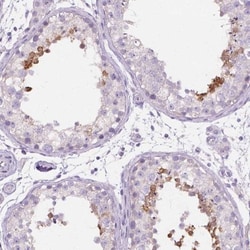 PDCL2 Antibody, Novus Biologicals:Antibodies:Primary Antibodies