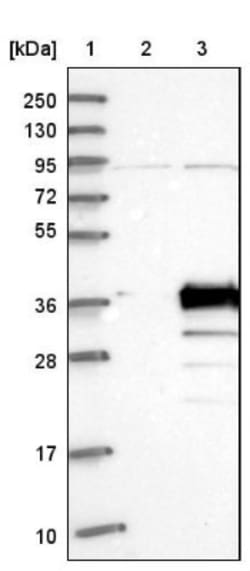 PDCL3 Antibody, Novus Biologicals 0.1mL; Unlabeled:Antibodies, Polyclonal