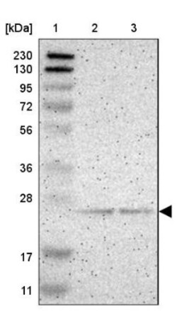 PDDC1 Antibody, Novus Biologicals 0.1mL; Unlabeled:Antibodies, Polyclonal