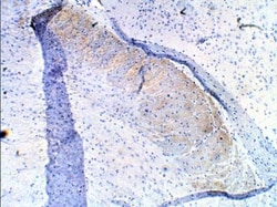 PDE10A Antibody, Novus Biologicals:Antibodies:Primary Antibodies