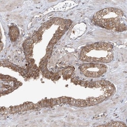 PDE11A Antibody, Novus Biologicals 0.1mL; Unlabeled:Antibodies, Polyclonal