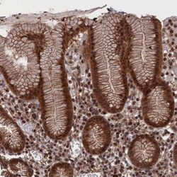 PDE12 Antibody, Novus Biologicals:Antibodies:Primary Antibodies