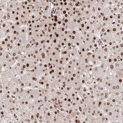 PDE1C Antibody, Novus Biologicals 25 &mu;L, Unlabeled:Antibodies, Polyclonal