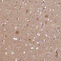 BEND2 Antibody, Novus Biologicals:Antibodies:Primary Antibodies