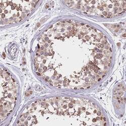 BEND2 Antibody, Novus Biologicals:Antibodies:Primary Antibodies