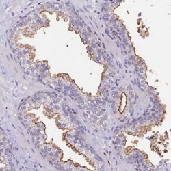 PDE6D Antibody, Novus Biologicals:Antibodies:Primary Antibodies