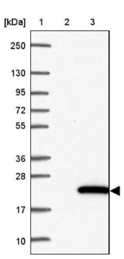 PDE6D Antibody, Novus Biologicals:Antibodies:Primary Antibodies