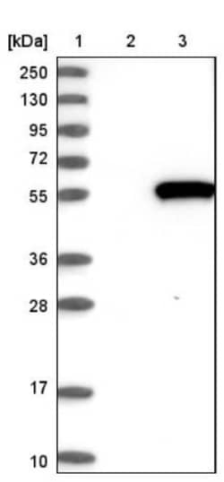 PDE7B Antibody, Novus Biologicals 25 &mu;L; Unlabeled:Antibodies, Polyclonal