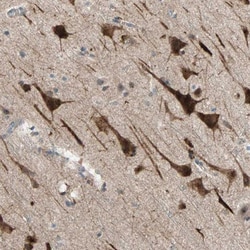 PDE8A Antibody, Novus Biologicals:Antibodies:Primary Antibodies