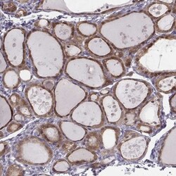 PDE8B Antibody, Novus Biologicals 0.1mL; Unlabeled:Antibodies, Polyclonal