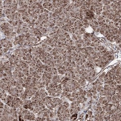 PDHX Antibody, Novus Biologicals 25 &mu;L; Unlabeled:Antibodies, Polyclonal
