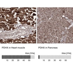 PDHX Antibody, Novus Biologicals 25 &mu;L; Unlabeled:Antibodies, Polyclonal
