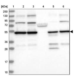 PDHX Antibody, Novus Biologicals 25 &mu;L; Unlabeled:Antibodies, Polyclonal