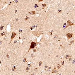 PDIA2 Antibody, Novus Biologicals 0.025mL; Unlabeled:Antibodies, Polyclonal