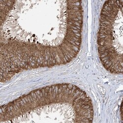PDIA6 Antibody, Novus Biologicals:Antibodies:Primary Antibodies