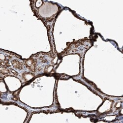 PDIA6 Antibody, Novus Biologicals:Antibodies:Primary Antibodies