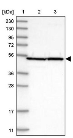 PDIA6 Antibody, Novus Biologicals:Antibodies:Primary Antibodies