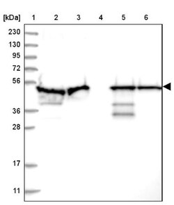PDIA6 Antibody, Novus Biologicals 25 &mu;L, Unlabeled:Antibodies, Polyclonal