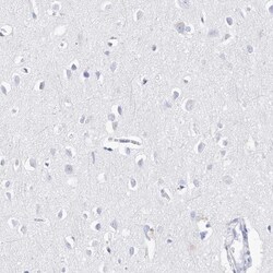 PDIR Antibody, Novus Biologicals 25 &mu;L | Buy Online | Novus Biologicals | Fisher Scientific