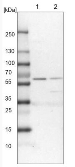 PDIR Antibody, Novus Biologicals 0.1mL; Unlabeled:Antibodies, Polyclonal