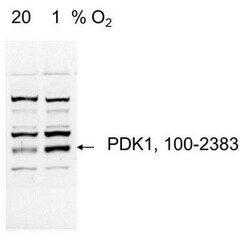 Pyruvate Dehydrogenase Kinase 1/PDK1 Antibody, Novus Biologicals 0.1mL;