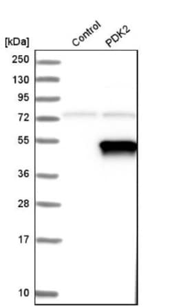 PDK2 Antibody, Novus Biologicals 0.1mL; Unlabeled:Antibodies, Polyclonal