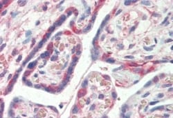 PDLIM1 Antibody, Novus Biologicals 0.1mg; Unlabeled:Antibodies, Polyclonal